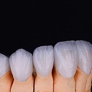 Zirconia Crowns