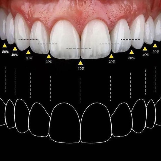 3D Smile Designing