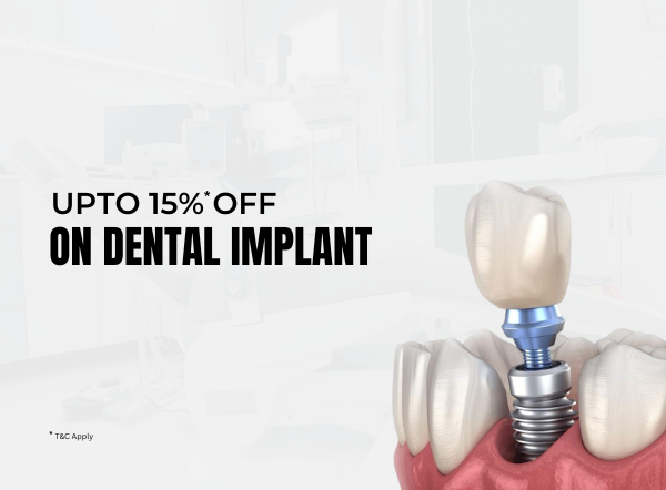 dental implant